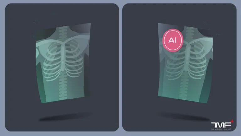AI, radiomics, radiology, X-ray