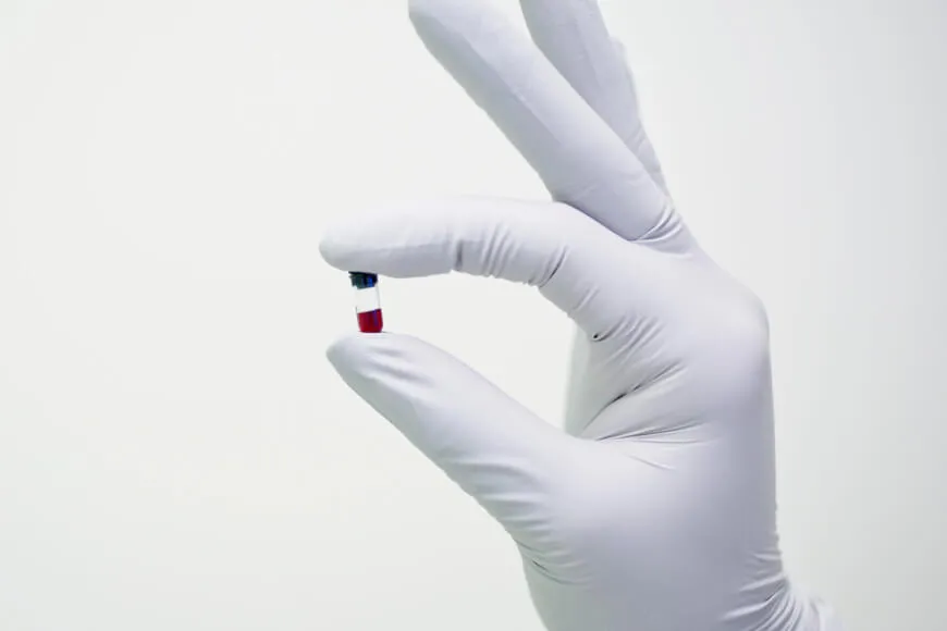 Why Theranos Will Decide The Future of Medical Innovation