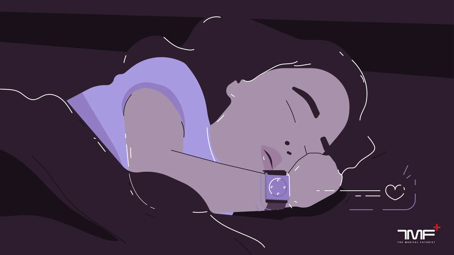 seizure alert watch
