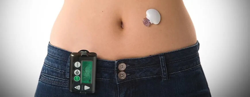 artificial pancreas