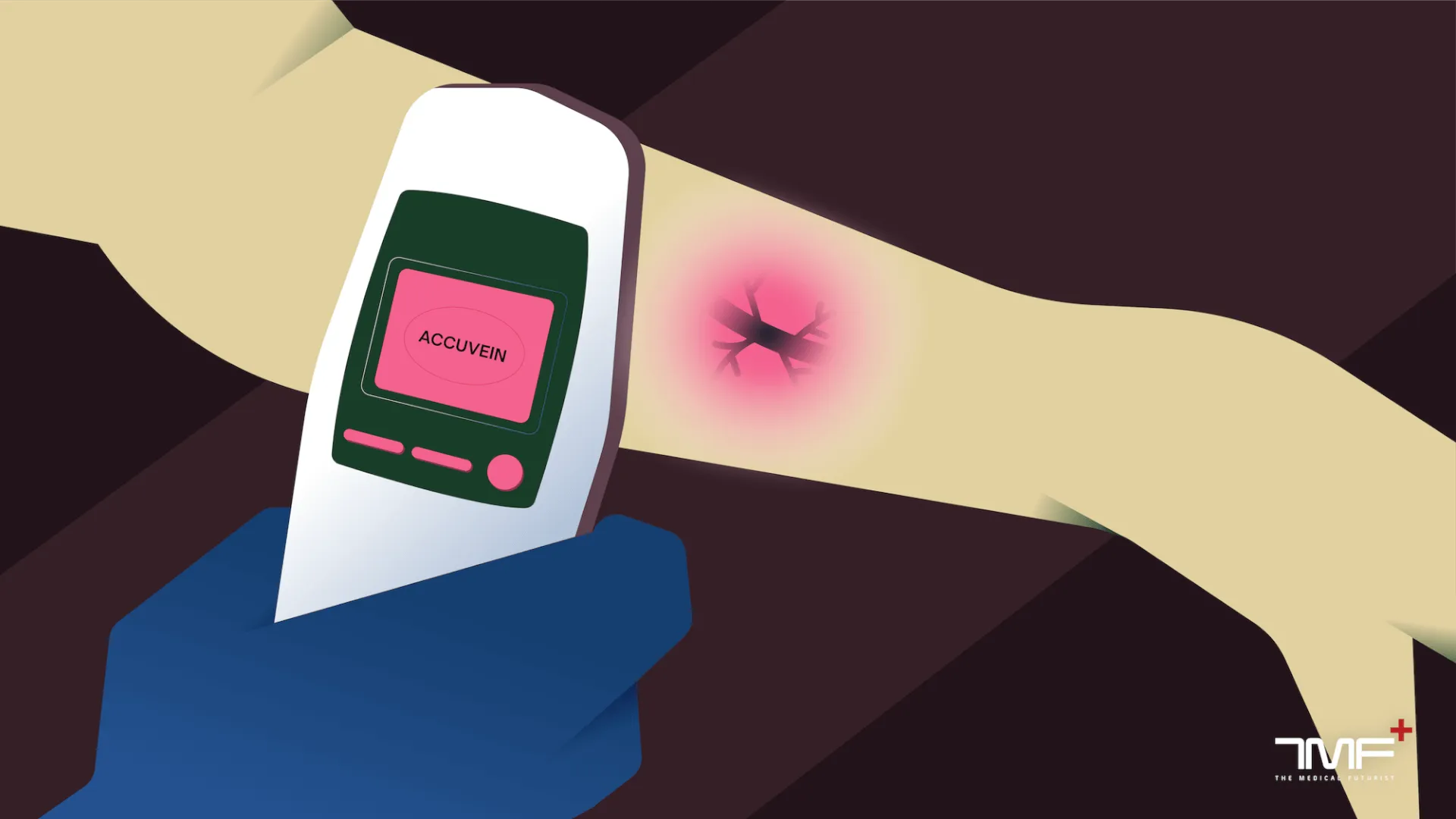 Augmented Reality Helping Vein Scanners – Too Distant A Dream In Healthcare?