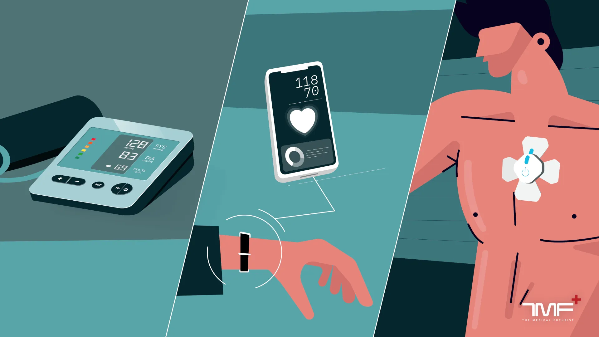 From Cuff To Cuffless: The Evolution Of Blood Pressure Monitoring