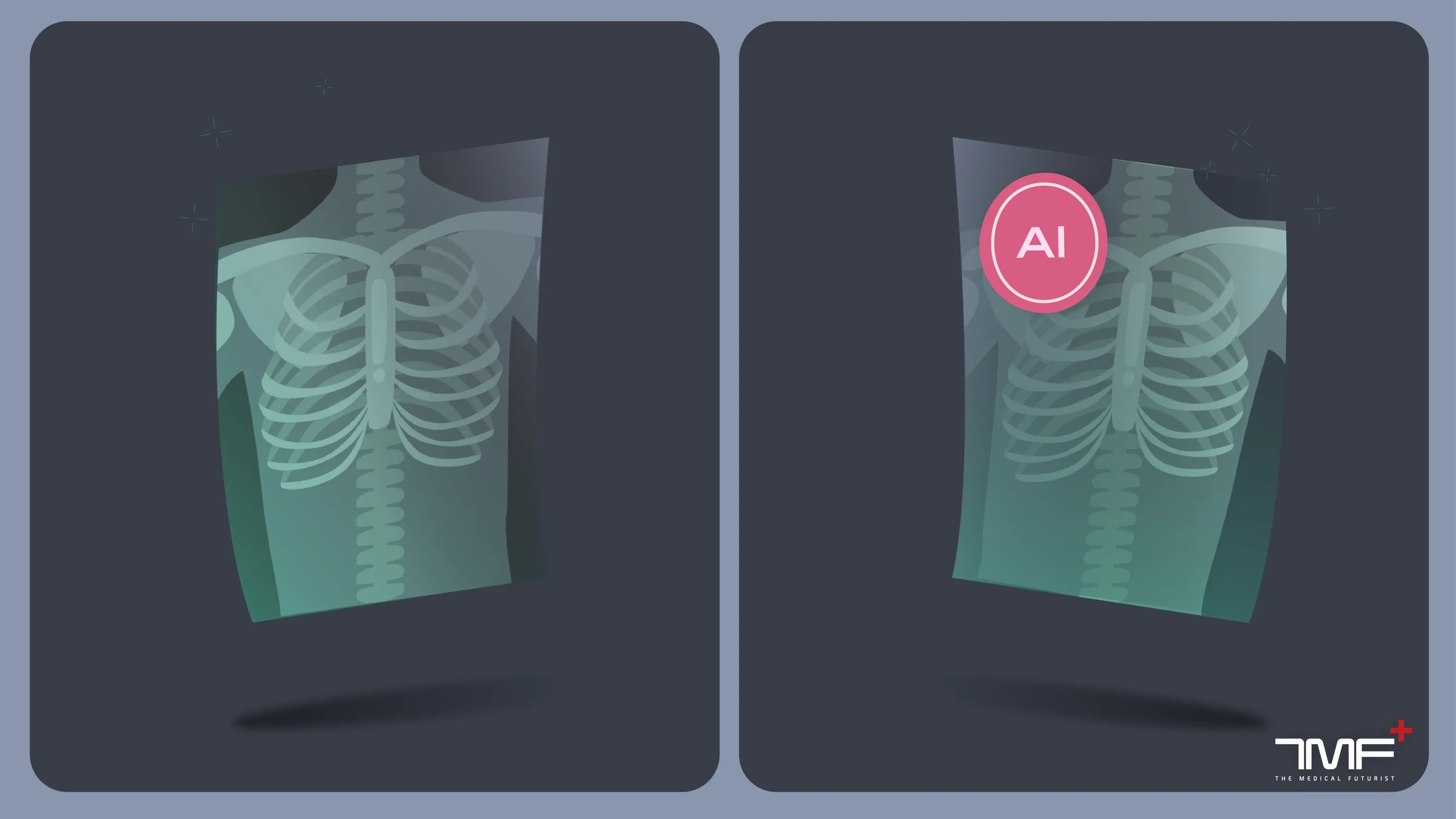 AI, radiomics, radiology, X-ray