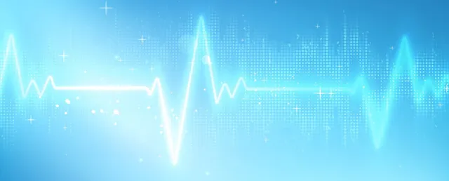 ecg