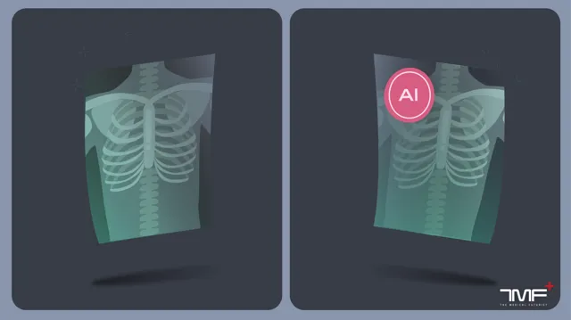 AI, radiomics, radiology, X-ray